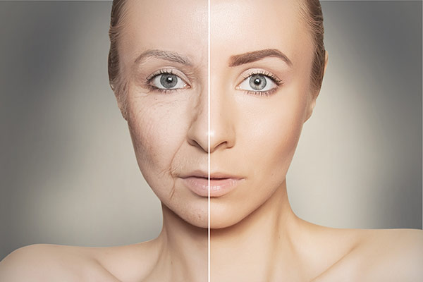 Scarlet RF Microneedling by Eugenia Berchenko